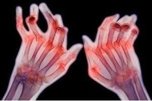 귢ʪԹؽ׵ʲôص
