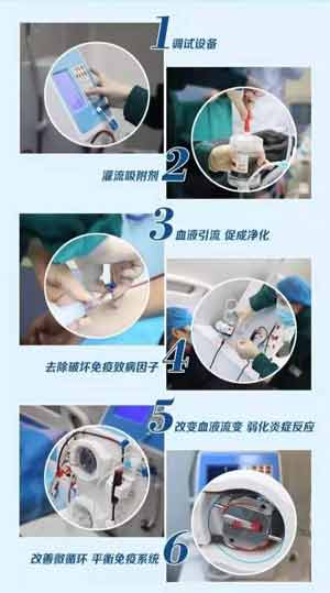 免疫吸附疗法五大特点.jpg 免疫吸附疗法三大优势.jpg 免疫吸附疗法五大特点.jpg 免疫吸附疗法三大优势.jpg
