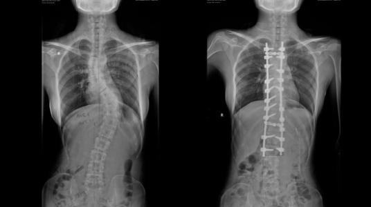  MRI——ǿֱԼ׵