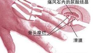  ʹ综Ѫ֬ߺȲ?